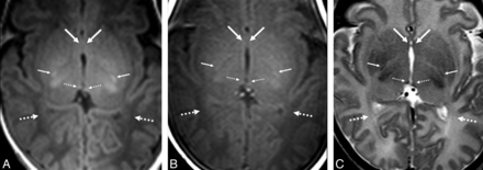 Fig 1.