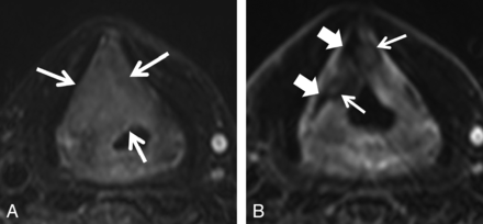 Fig 2.