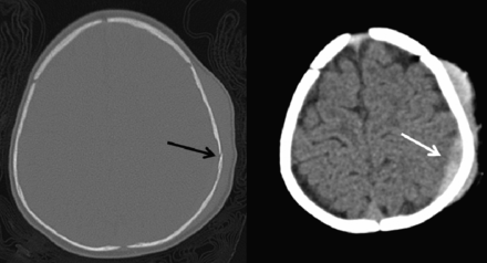 Fig 4.