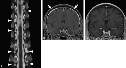 Fig 1.