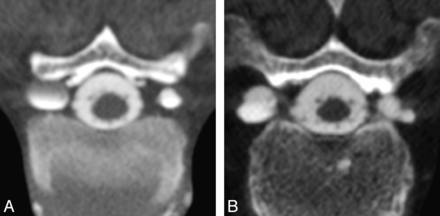 Fig 2.