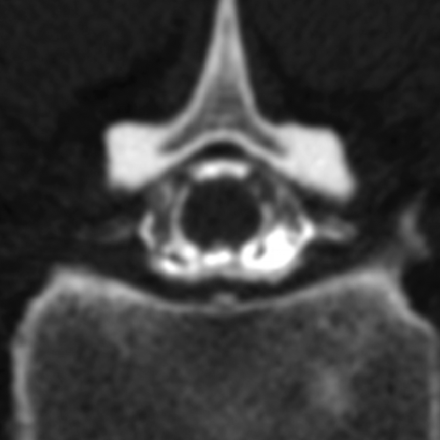 Fig 5.
