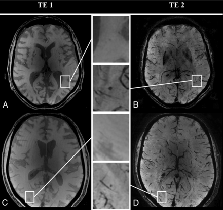 Fig 2.