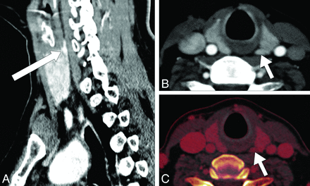 Fig 1.