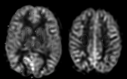 Fig 1.