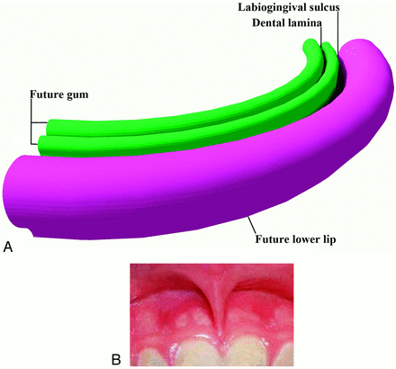 Fig 3.