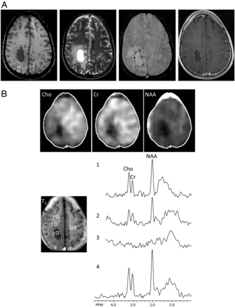 Fig 2.