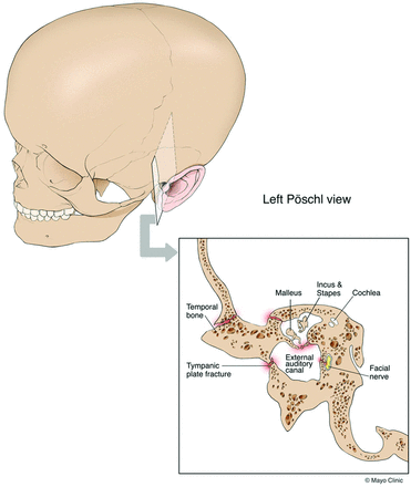 Fig 2.