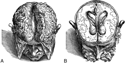 Fig 1.