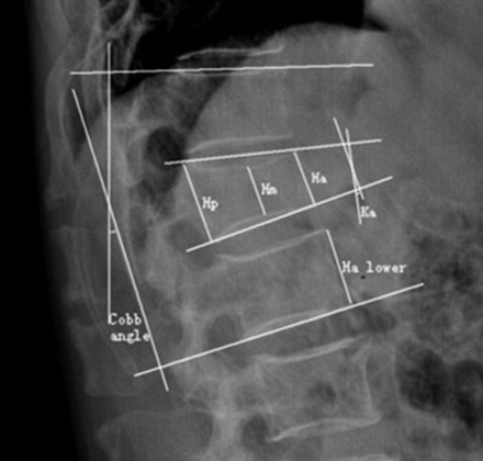 Fig 2.