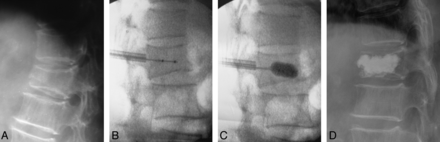 Fig 4.