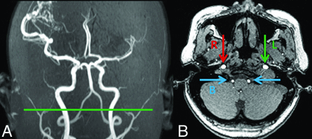 Fig 1.