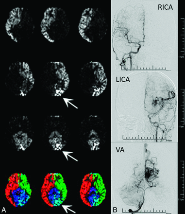 Fig 4.