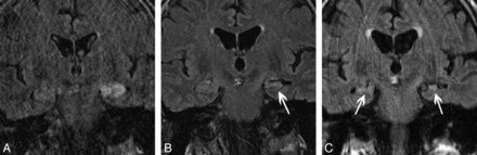 Fig 1.
