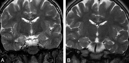 Fig 5.