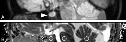 Fig 3.