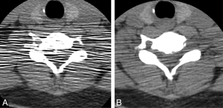 Fig 1.