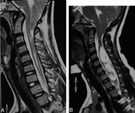 Fig 3.