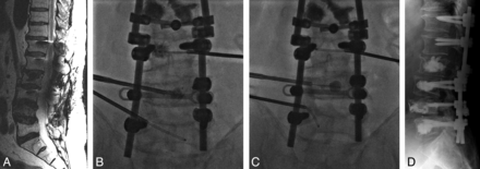 Fig 3.