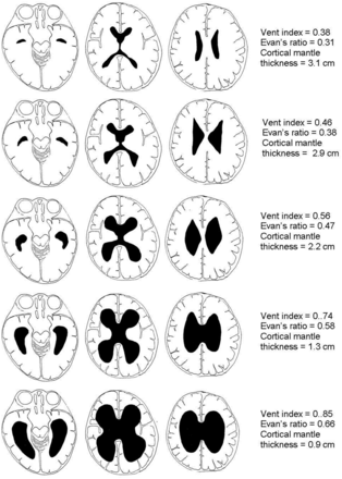 Fig 2.