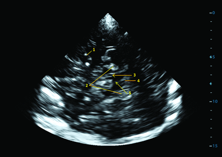 Fig 1.