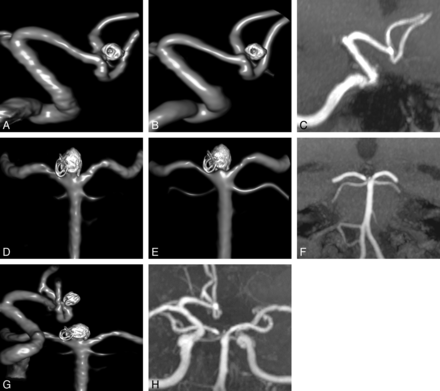 Fig 2.