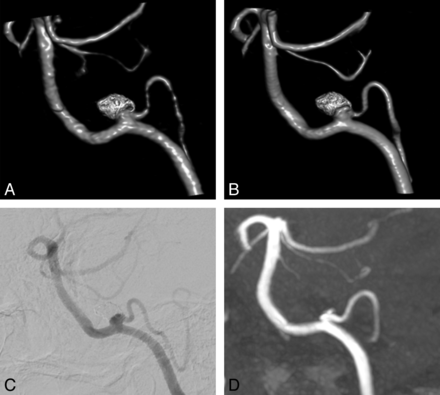 Fig 3.