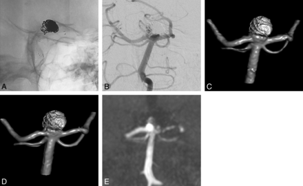 Fig 4.
