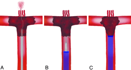 Fig 3.