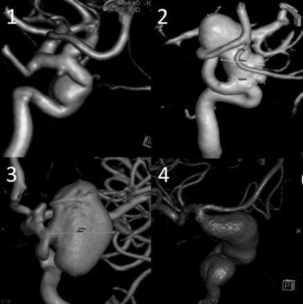Fig 10.