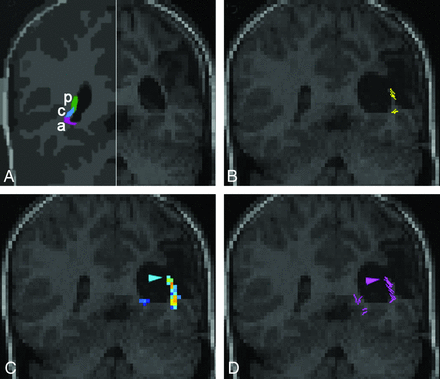 Fig 3.