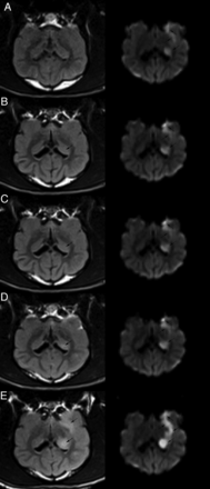Fig 2.
