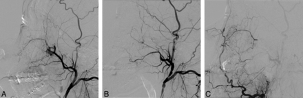 Fig 1.