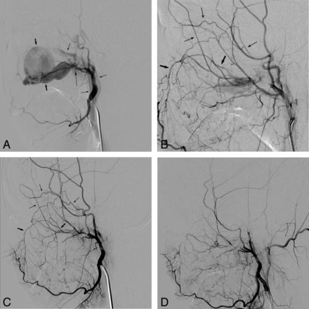 Fig 2.