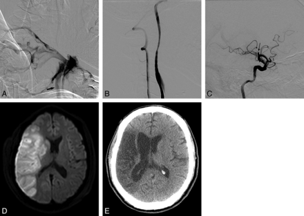 Fig 4.