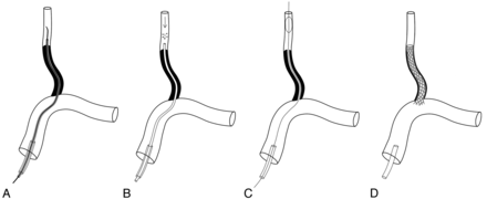 Fig 2.