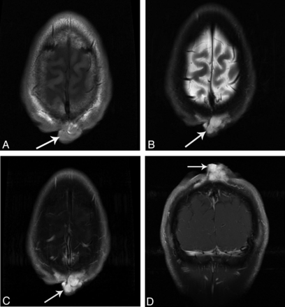 Fig 2.