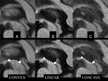 Fig 3.
