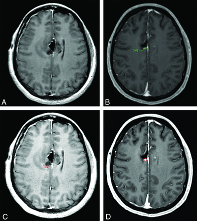 Fig 2.