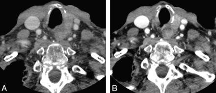 Fig 1.