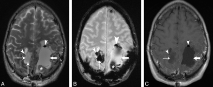 Fig 1.