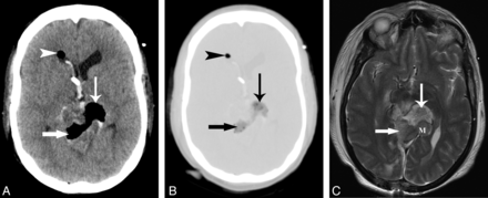 Fig 2.