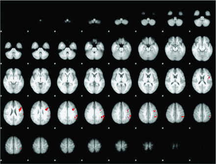 Fig 4.