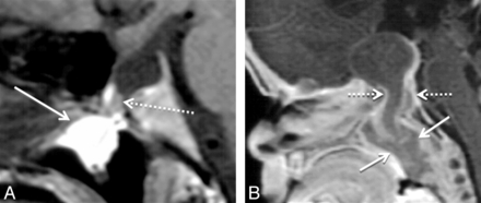 Fig 4.