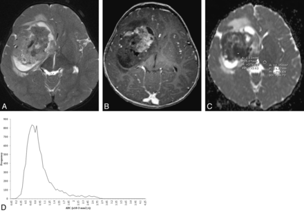 Fig 2.