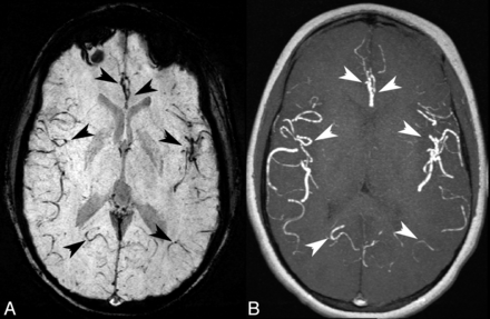 Fig 2.