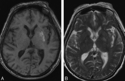 Fig 2.