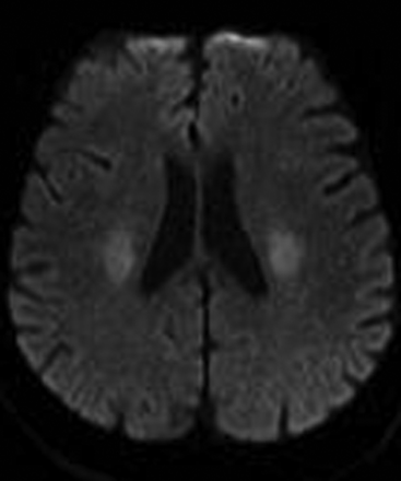 Fig 5.