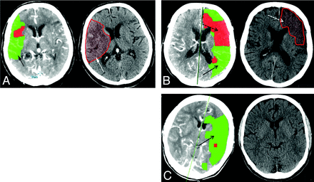 Fig 5.