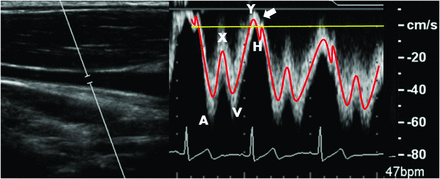Fig 3.